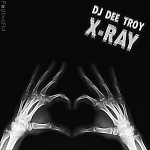 X-Ray (winter)